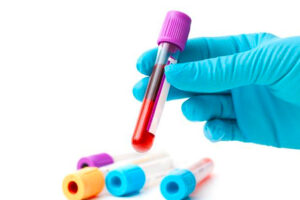 Gruppo sanguigno e rischio diabete Tipo 2