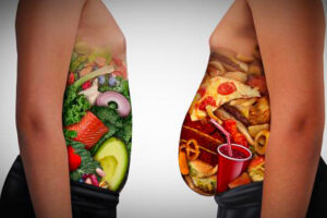 Obesità, fattore di rischio numero uno per diabete Tipo 2