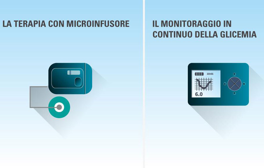 Microinfusore per monitoraggio continuo del diabete