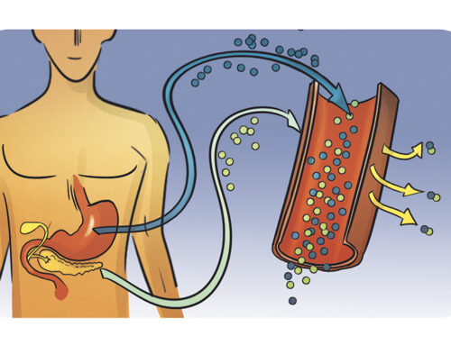 4 – Diabete Mellito tipo 2